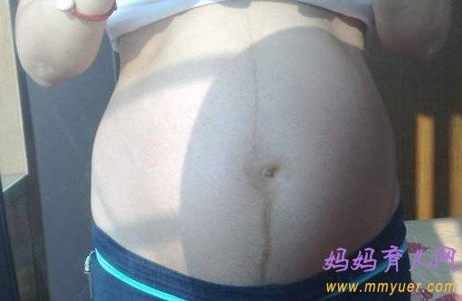 看妊娠纹判断生男生女超准 生儿子的妊娠线图片