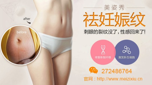 去妊娠纹用什么牌子的产品好，不懂就看这